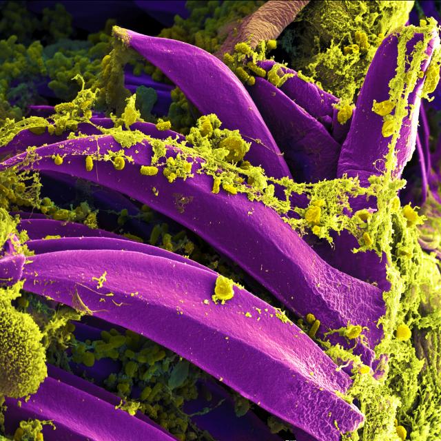 Photo au microscope de la bactérie causant la peste noire. On voit des filaments violets en forme d'os de seiche avec une sorte de mousse verte.